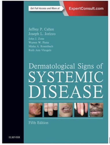 Dermatological Signs of Systemic Disease