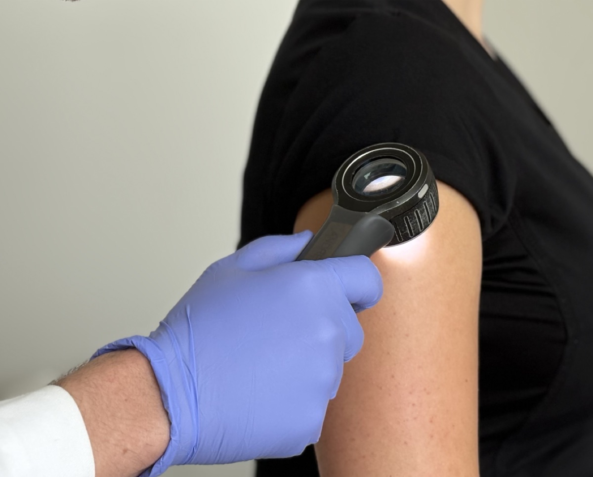 Dermoscopic skin examination